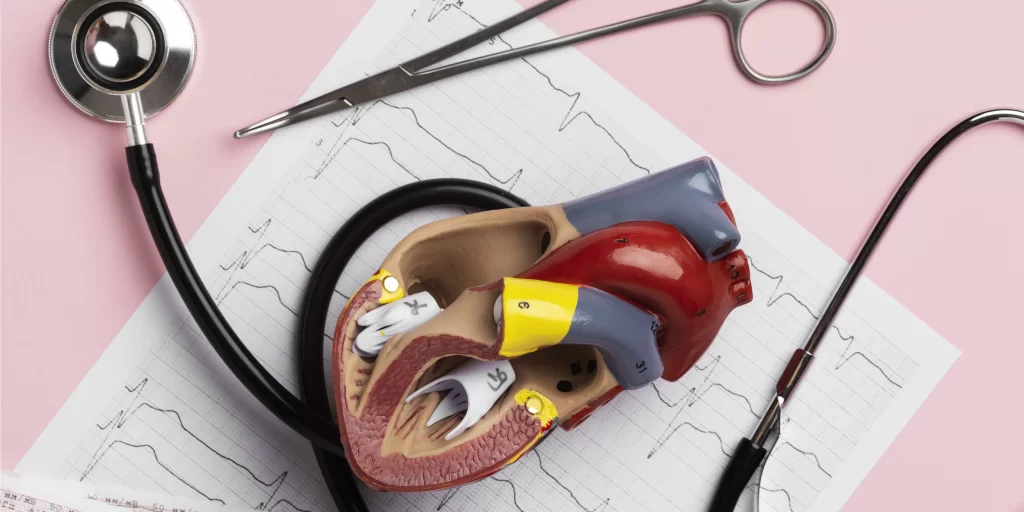 bypass surgery vs angioplasty