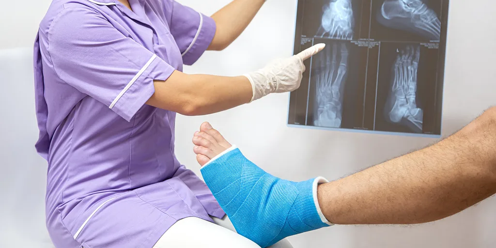 Medical professional reviewing foot and ankle X-rays while a patient with a blue plaster cast on their leg is seated. Image represents fracture diagnosis and treatment.