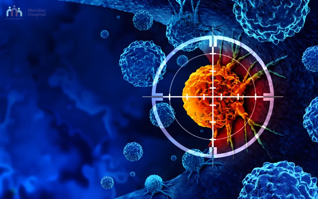 Best cancer hospital in Chennai