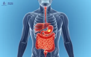 Best gastroenterology hospital in Chennai