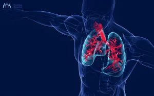 Best pulmonology hospital in Chennai
