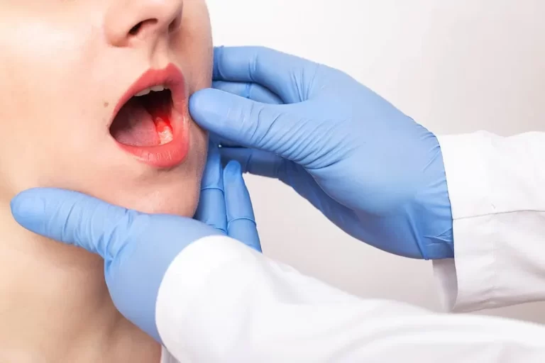 Mouth cancer symptoms India