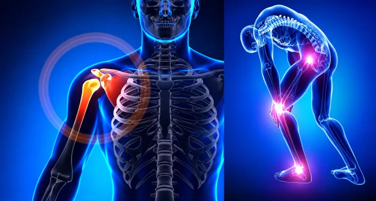 orthopaedic hospital in Chennai